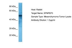 XPNPEP3 Rabbit anti-Human, Polyclonal, Novus Biologicals 0.1 mL | Buy Online | Novus Biologicals | Fisher Scientific